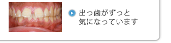 出っ歯がずっと気になっています